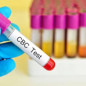 Complete Blood Count (CBC)