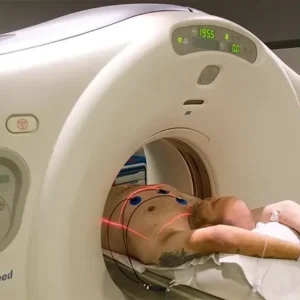 CT Coronary Angiogram